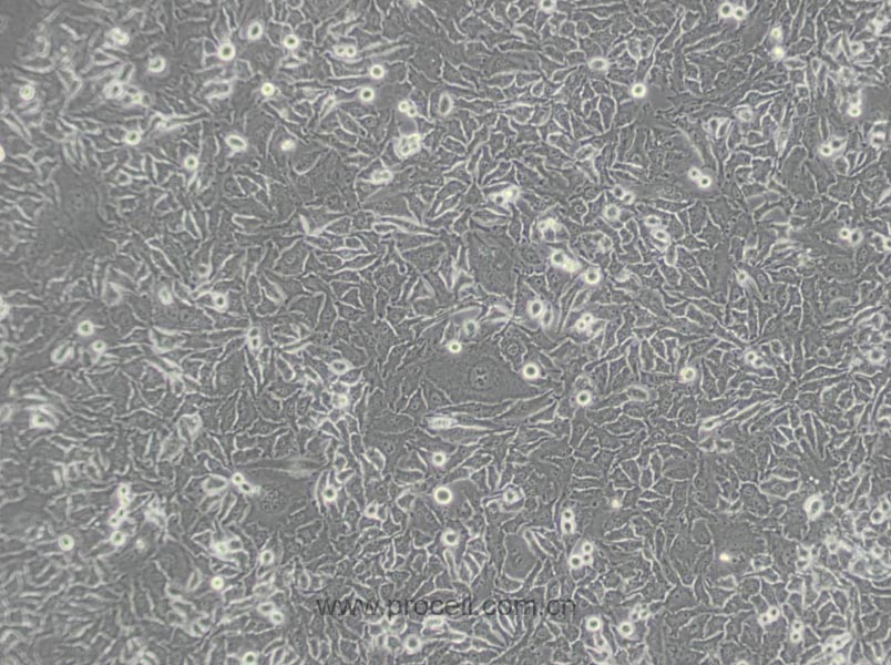 Hela（人宫颈癌细胞）(通过STR鉴定)