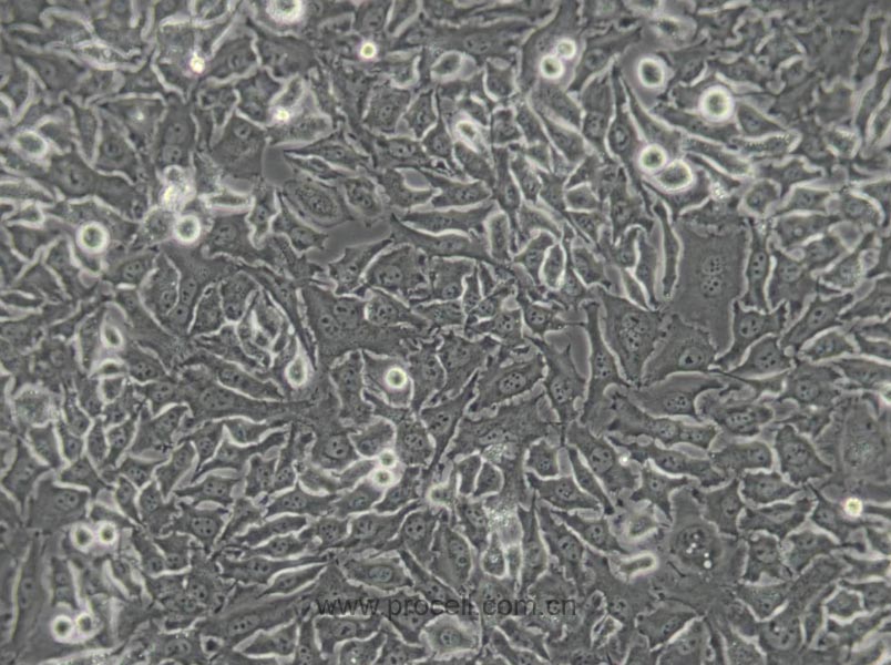 Hela（人宫颈癌细胞）(通过STR鉴定)