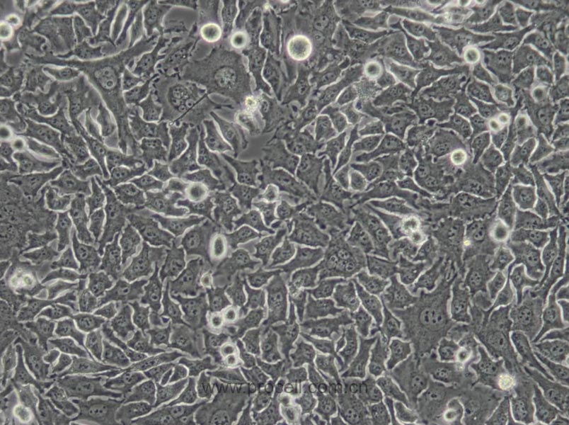 Hela（人宫颈癌细胞）(通过STR鉴定)
